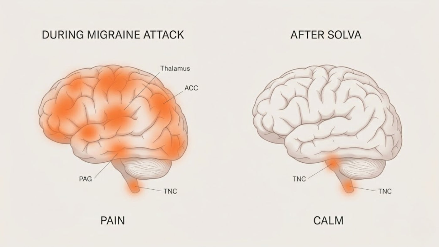 The Solva migraine relief device.